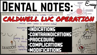 CALDWELL LUC OPERATION || MAXILLARY SINUS || ORAL SURGERY || imp