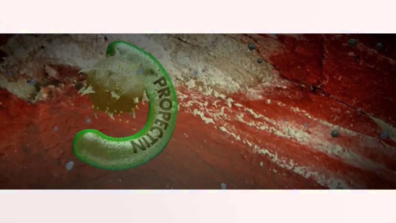 How to treat radiation contamination (cesium137) 