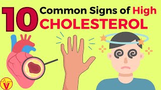 10 Common Signs of High CHOLESTEROL You SHOULD NOT Ignore | VisitJoy