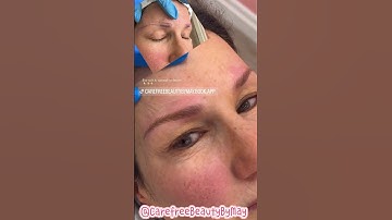 Brows are all you need #nothingelsematters #perfectbrows #allaboutbrows #permanentbrows