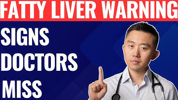 Warning Signs You Have a FATTY LIVER (Silent Threat)