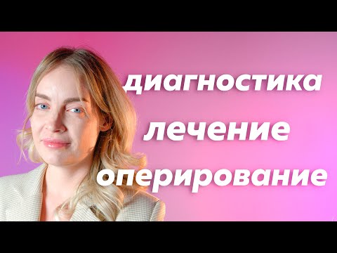 Эндометриоидные кисты яичников