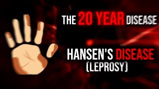 The 20 Year Disease  Hansen's Disease (Leprosy)