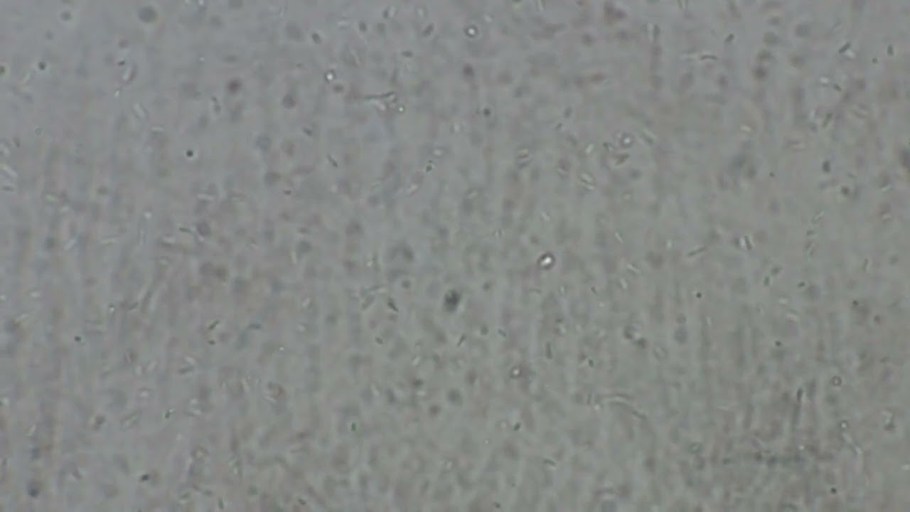 Microbiogenic secondary Gold research on local ore samples -Dr Sujata Dabolkar got positive results