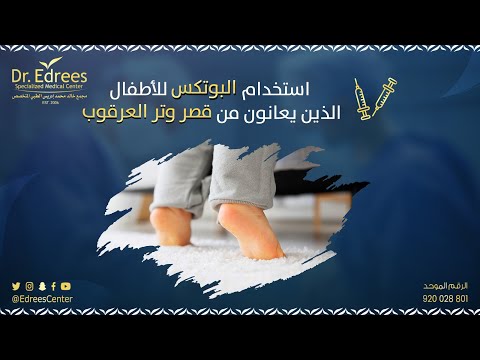 د خالد ادريس و استخدامات البوتكس لاطالة وتر العرقوب
