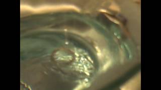 Anti-Bubble/The Opposite of the Bubbles you Know about