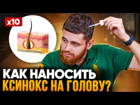 Как наносить ксиноксин НА ГОЛОВУ, чтобы волосы 100 НАЧАЛИ РАСТИ