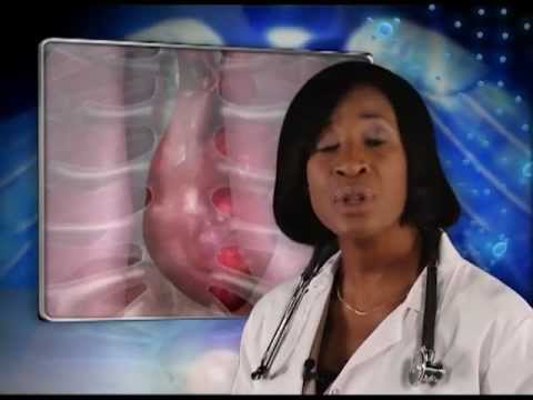 3d animation internships Part 7 - Cholesterol, Obesity, Diabetes, High Blood Pressure