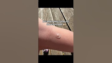 Essential Pimple Patches for Flawless Skin! #fok #pimple #acne