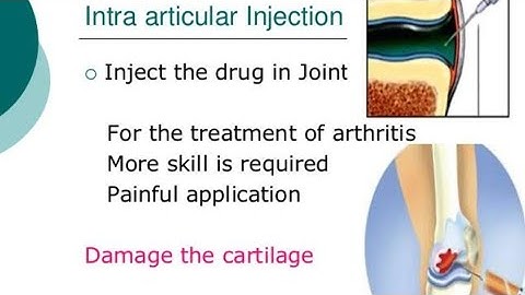 Intra-Articular and Intra-Thecal Route of drug Adm