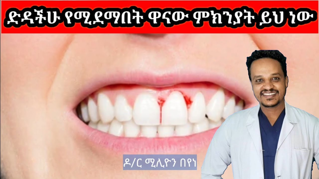 ዋናውና የመጀመሪያው የድድ መድማት ምክንያትን እወቁ@ዶርሚሊዮንDrMillion