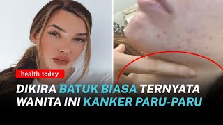 Viral! Dikira Batuk Biasa Ternyata Kanker Paru Paru, Bedakan Gejalanya | Health Today #200