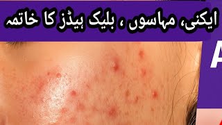 Pillpalace: Acne treatment creams In Pakistan