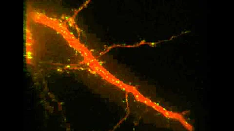 BDNF-treated Neuron