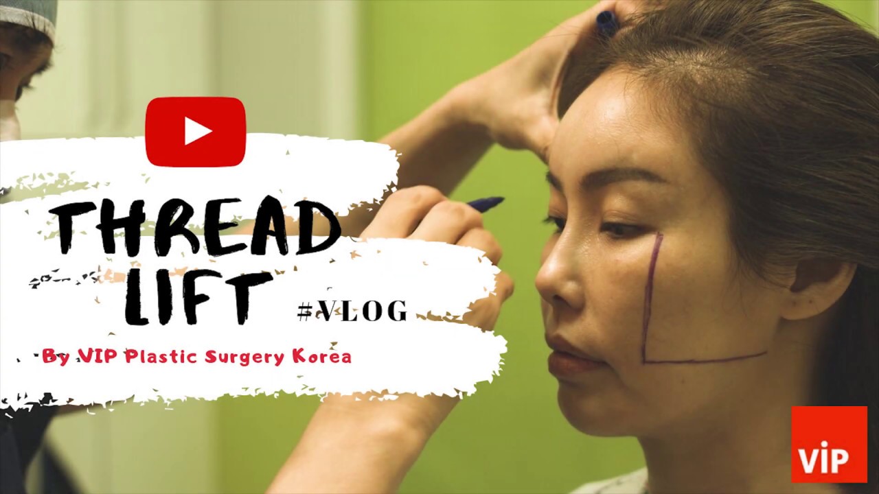 Thread Lift VLog VIP Plastic Surgery Clinic Korea Tổng quát những