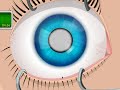 Operate now  eye surgery  play eye surgery game online