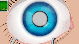 OPERATE NOW : EYE SURGERY | PLAY EYE SURGERY GAME ONLINE