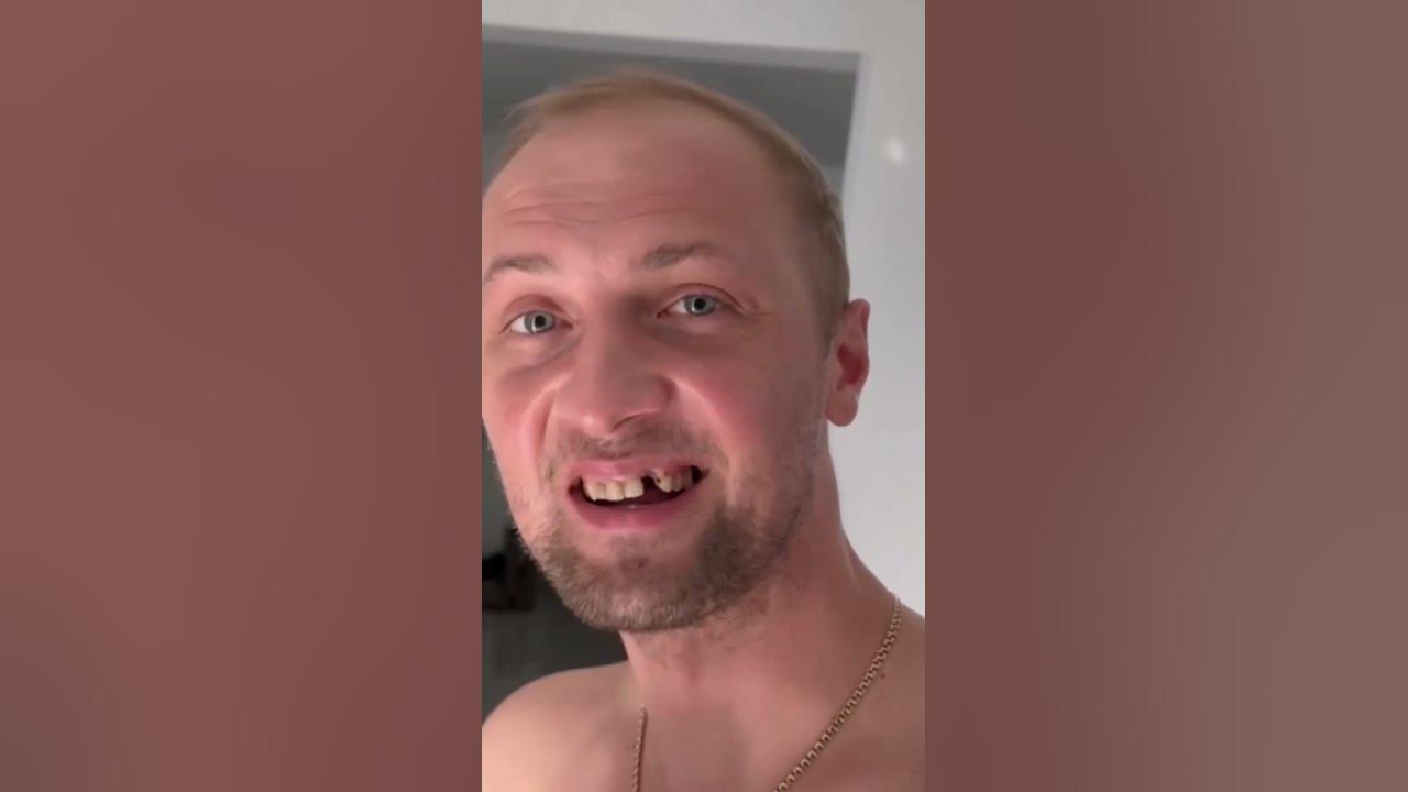 Зубарев смешные фото У ЗУБАРЕВА ВЫПАДАЮТ ЗУБЫ #shorts #зубарев #зубнойврач #зубоф #моргенштерн - YouT
