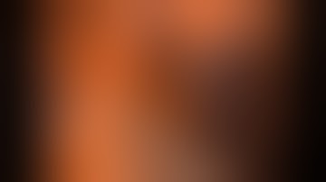 Asvide: Three-port VATS right posterior (S2) segmentectomy: a recurrent A2 is clearly evident