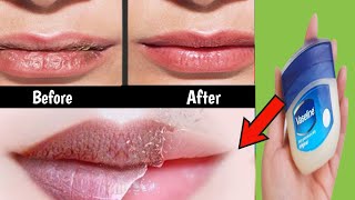 How to turn your lips from chapped, gray and dry to pink and healthy without makeup/soft pink lips screenshot 5