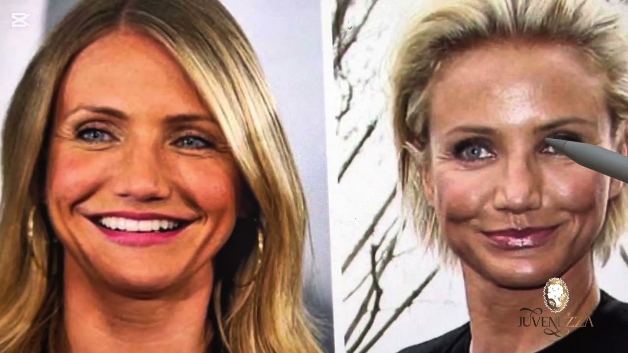 Que sucedió con el Botox de Cameron Díaz? 