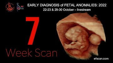 7 Week Scan in Fetal Medicine: Early Fetal Scan Conference 2022
