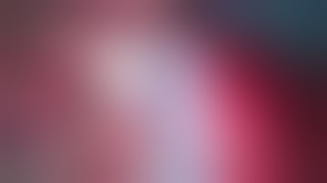 P.Com. Aneurysm with a fetal configuration