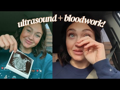 Surrogacy Journey Update: Lining Check & Hormone Levels before Embryo Transfer  thumbnail