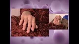 Roche Maroc et l'AMLAR partenaires pour la lutte contre la polyarthrite rhumatoïde