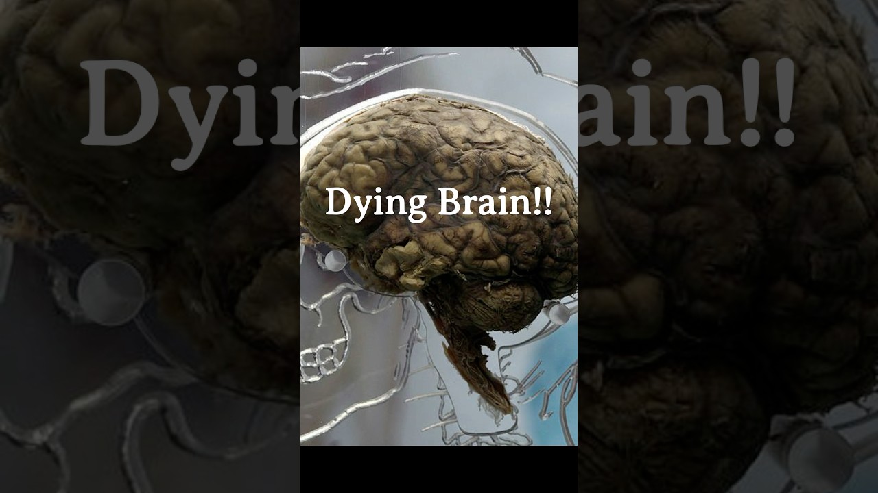 What Happens in a Dying Brain!!