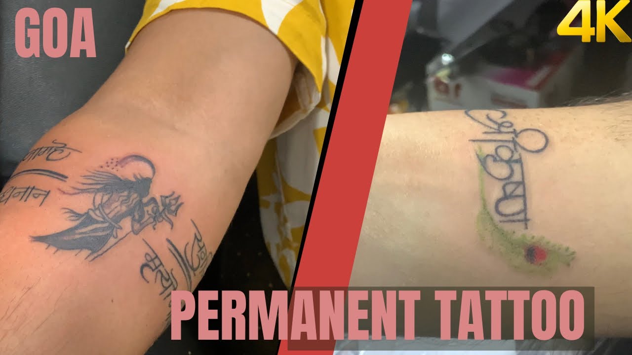 Laser Tattoo Removal in Santa Rosa