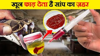 सांप के जहर से इंसानी खून की क्या हालत होती हैं | What Happens If Snake’s Venom Mixed in Human Blood screenshot 1