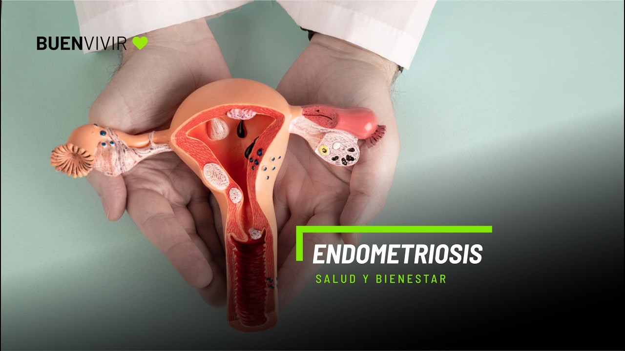 ENDOMETRIOSIS - Clínica Suizo Americana - BUENVIVIR💚 13/03/26 Canal 4