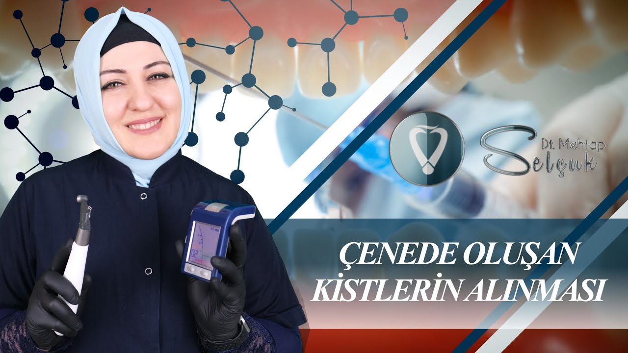 Çenede Oluşan Kistlerin Alınması