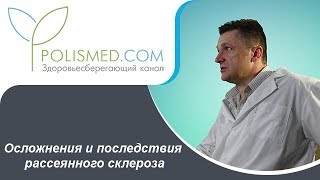 Осложнения и последствия рассеянного склероза. Сколько живут с рассеянным склерозом Осложнения и последствия рассеянного склероза. Сколько живут с рассеянным склерозом