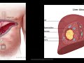 سونار المرحلة الرابعة تقنيات الاشعه Normal And Abnormal Liver In Ultrasound المنهج الوزاري 2025 