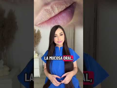 ¿Tienes estos granitos? #granitosenloslabios #gránulosdeFordyce #salud #información #drapauzúñga