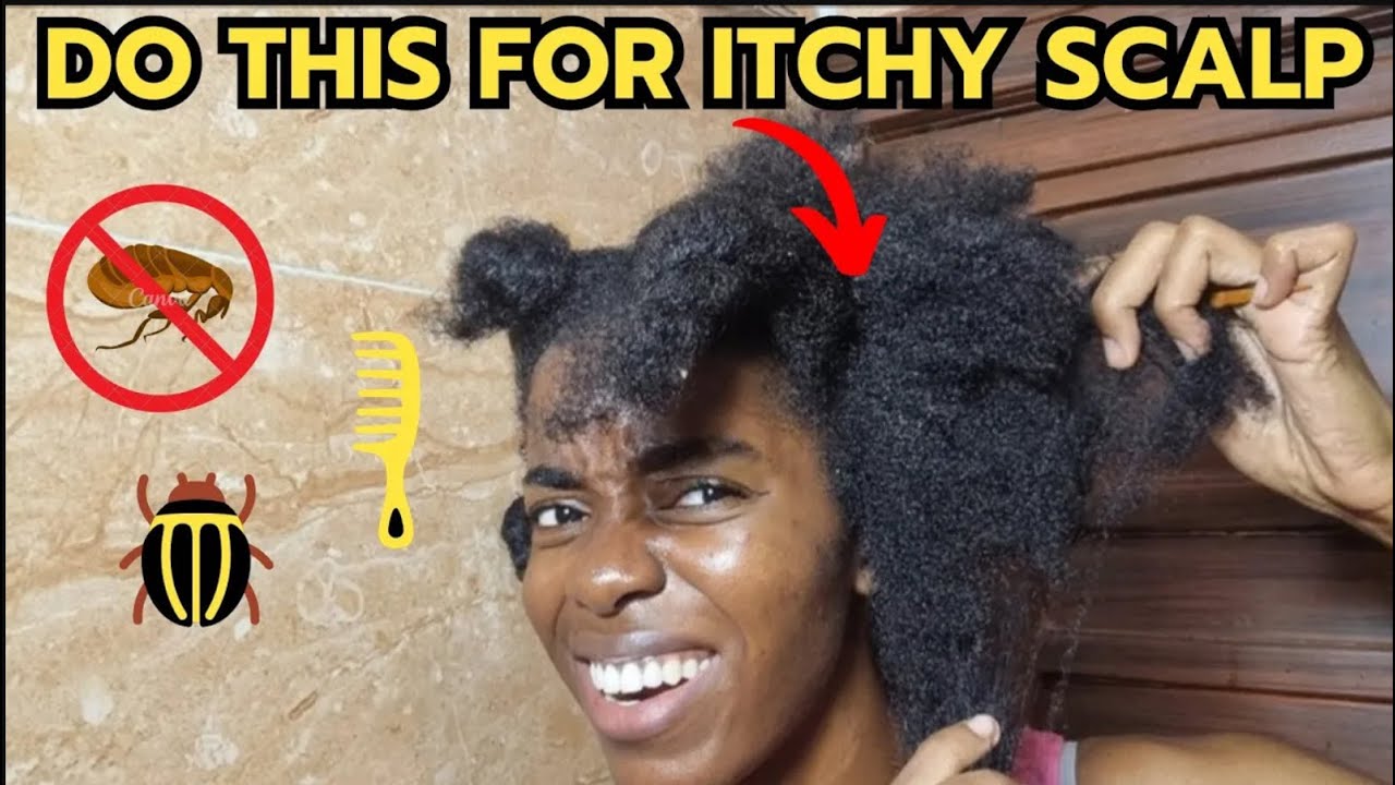 КАК УСТРАНИТЬ ЗУД КОЖИ ГОЛОВЫ