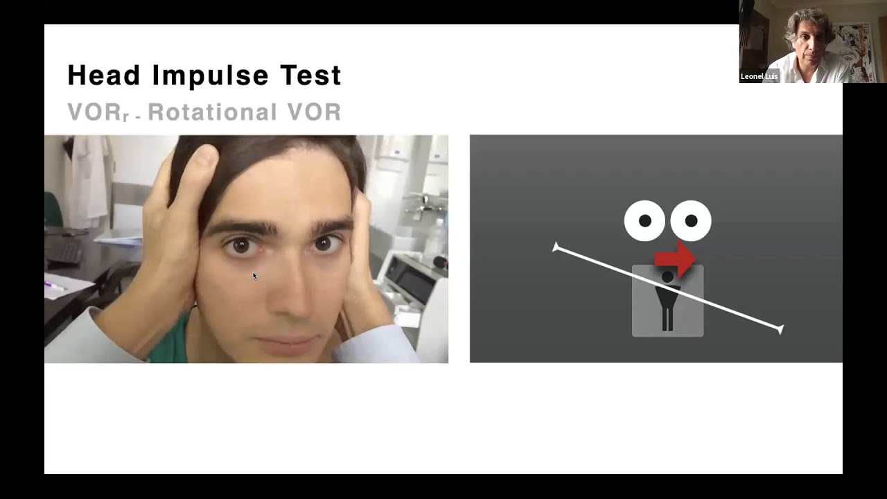 The Video head impulse test:| Leonel Luis