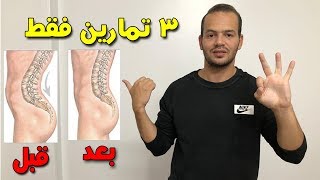 3 تمارين لحل مشكلة بروز المؤخرة