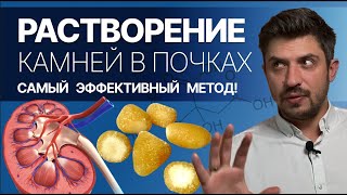 Как растворить камни в почках без операции! Самый эффективный метод. Уролог Игорь Матюхов