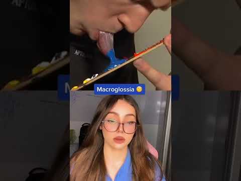 MACROGLOSSIA - ELE PINTA COM A LÍNGUA 😱