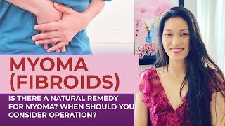Natural Remedy for Myoma (Fibroids). When Should You Consider Operation? | Dr. Farrah Video (2021)