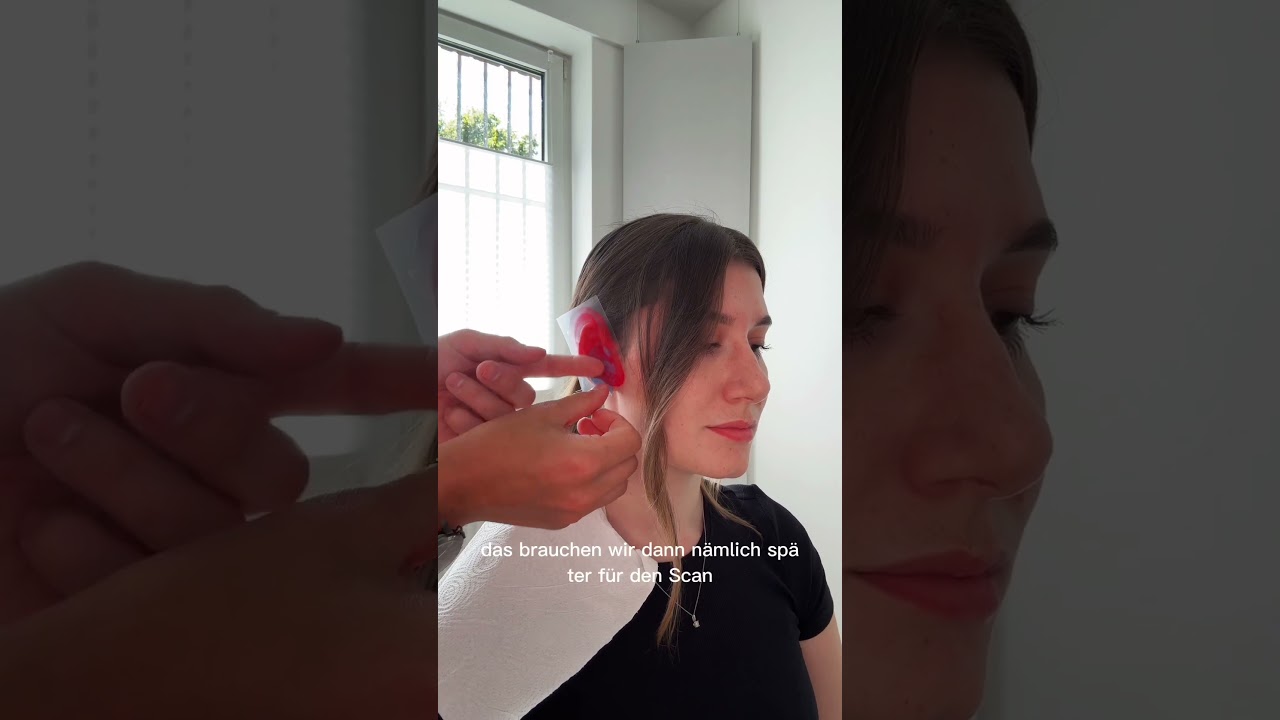 Part 1 Titan Otoplastik Anfertigung und Bestellung