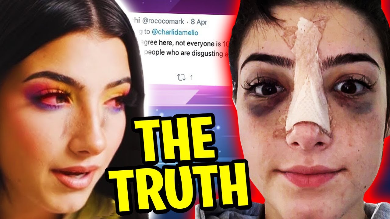 Why Did Charli D'amelio Get Surgery (The Hidden Truth) YouTube