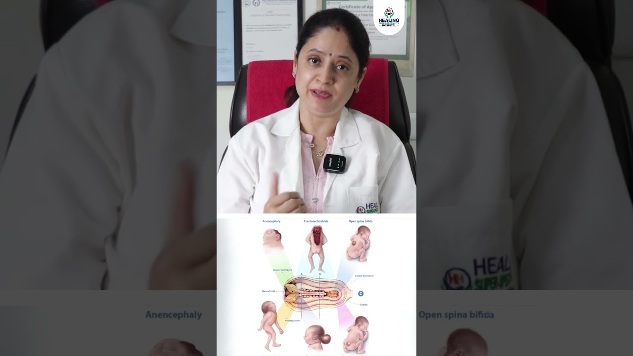 Why You Need Folic Acid During Pregnancy? #folicacid