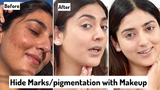 Hide Marks Pigmentation With Makeup Only 2 Steps100% Works