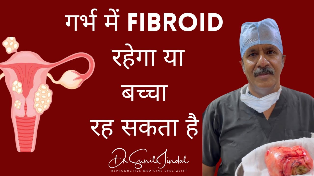 गर्भ में Fibroid रहेगा या बच्चा रह सकता है|Dr.Sunil Jindal|JINDAL HOSPITAL|MEERUT