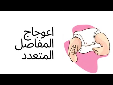 اعوجاج المفاصل المتعدد