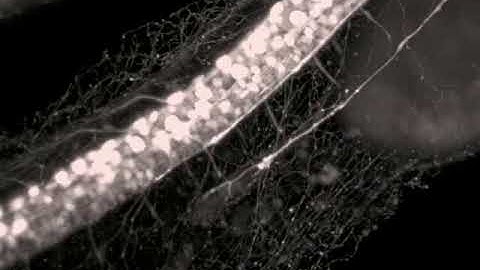 Timelapse of neuronal development